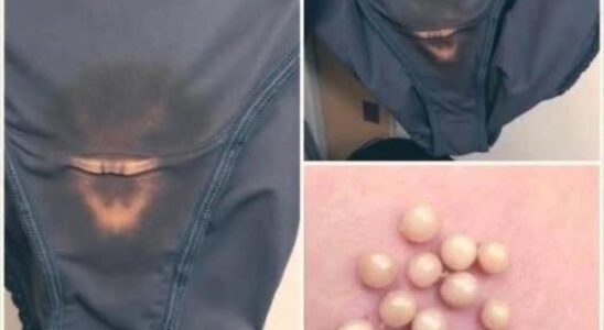 BE CAREFUL, if you notice this in your underwear, it means you have