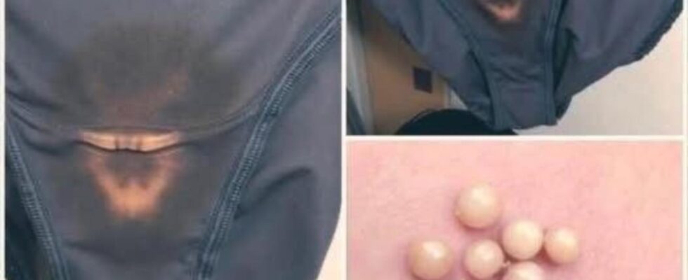 BE CAREFUL, if you notice this in your underwear, it means you have