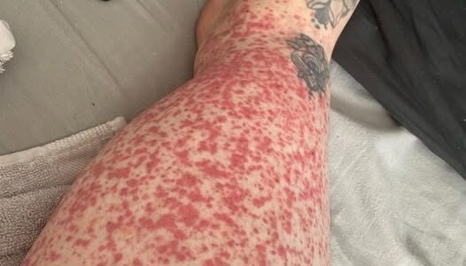 These are the consequences of sleeping in…