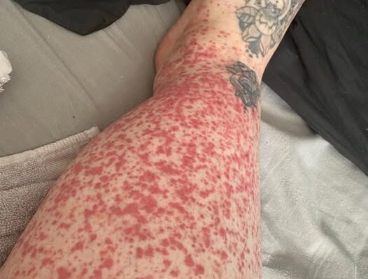 These are the consequences of sleeping in…