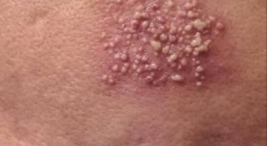 See These are the consequences of sleeping with…