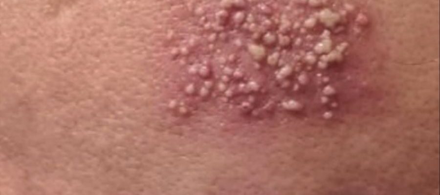 See These are the consequences of sleeping with…