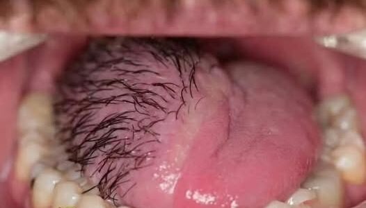These are the consequences of sleeping in the…