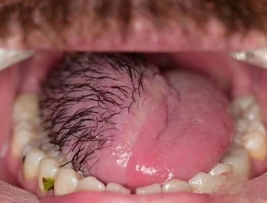 These are the consequences of sleeping in the…