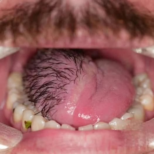 These are the consequences of sleeping in the…