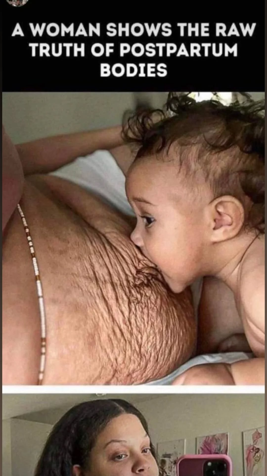 Postpartum Changes, Celebrity Moms Embracing Their Bodies