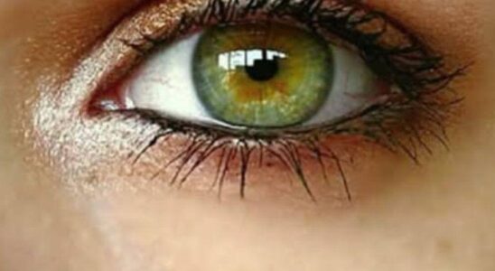 People with green eyes are special for these reasons