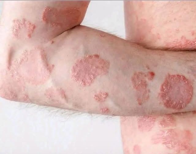These are the consequences of sleeping with…