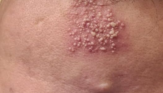 These are the consequences of sleeping…