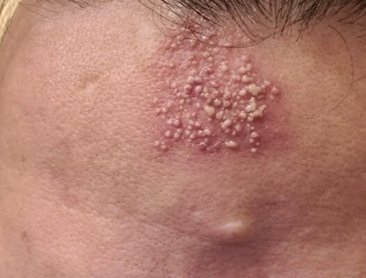 These are the consequences of sleeping…