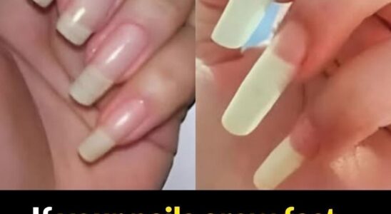 What It Really Means If Your Fingernails Grow Fast