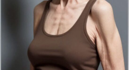 Everyone Was Shocked When This 72-Year-Old Woman Gained 25 Pounds — Here’s What Really Happened