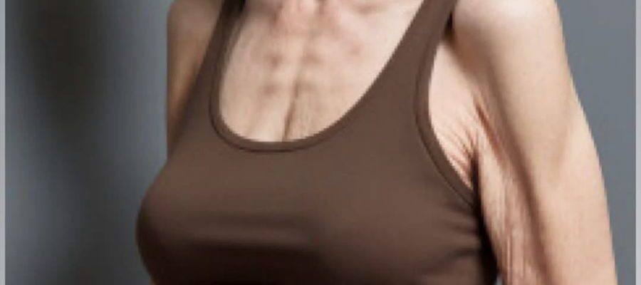 Everyone Was Shocked When This 72-Year-Old Woman Gained 25 Pounds — Here’s What Really Happened