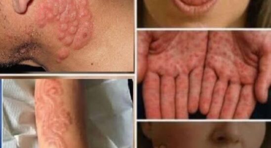 These are the signs that he is cr…