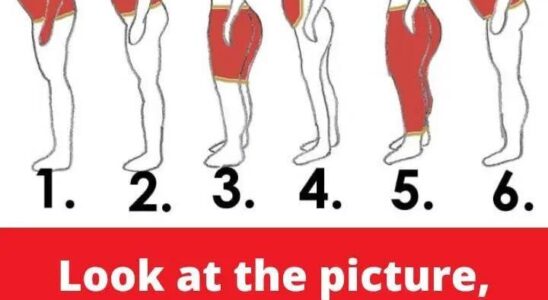 Identify Your Fat Distribution Type and Learn How to Address It