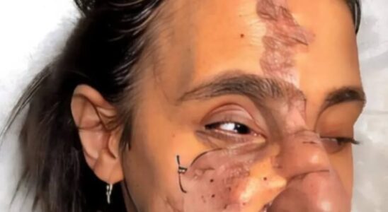 She Lived in the Shadows for 30 Years — Until a Makeup Artist Helped Her Shine