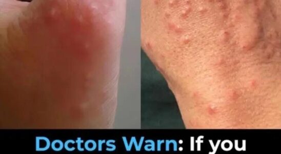 Don’t overlook these small red spots on your arm