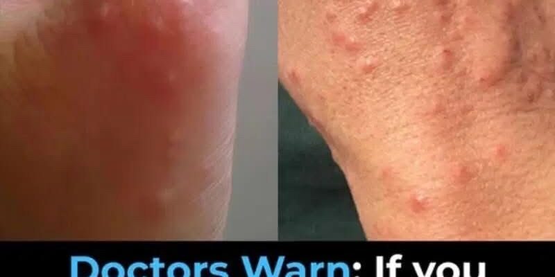 Don’t overlook these small red spots on your arm