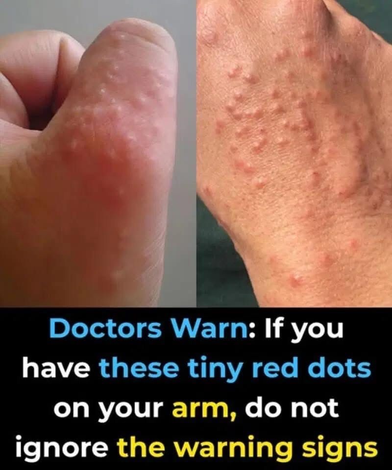 Don’t overlook these small red spots on your arm