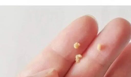 This appears in your mouth, you should be very careful