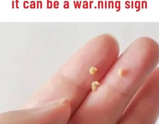 This appears in your mouth, you should be very careful