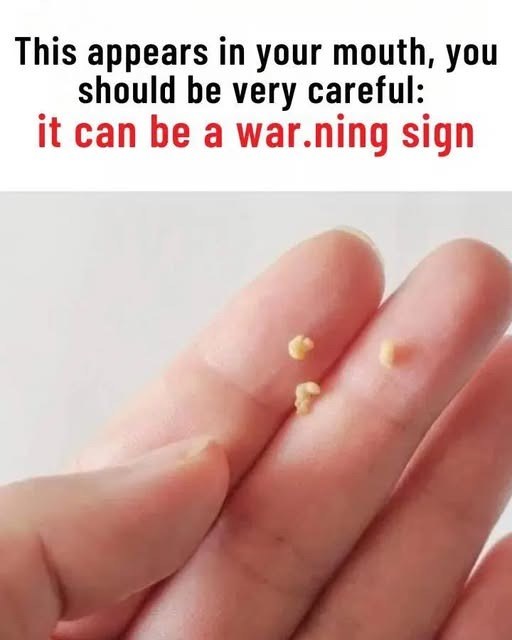 This appears in your mouth, you should be very careful