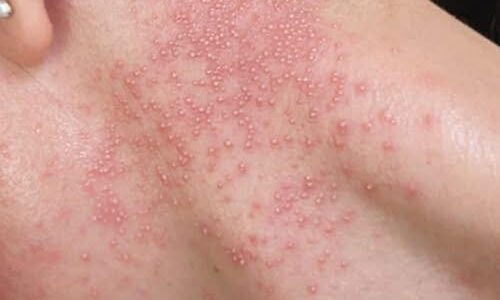 These are the consequences of eating…