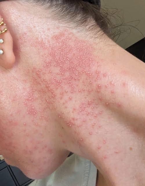 These are the consequences of eating…