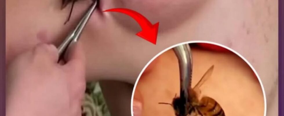 10 Bug Bites Anyone Should Be Able to Identify and…