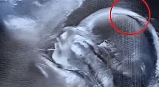 Doctors couldn’t believe what they saw during the ultrasound