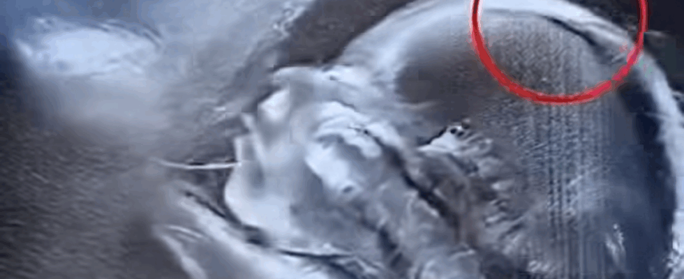 Doctors couldn’t believe what they saw during the ultrasound