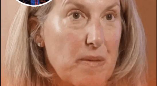 She Nearly Lost Her Liver After Taking This Common Supplement