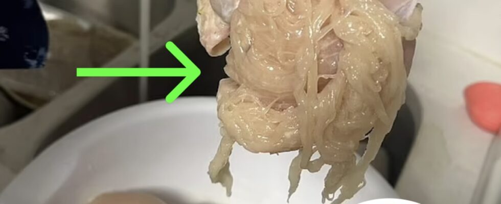 Mom Shares Photo Of Chicken Breast