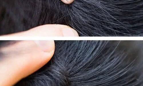 Just Discovered This in My Son’s Hair — What Is It?