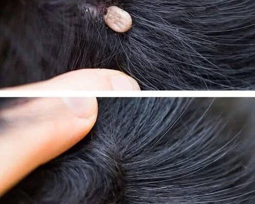 Just Discovered This in My Son’s Hair — What Is It?