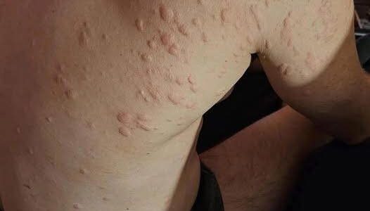 Unexpected Consequences of Sleeping with the Wrong Person”