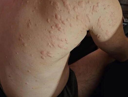 Unexpected Consequences of Sleeping with the Wrong Person”