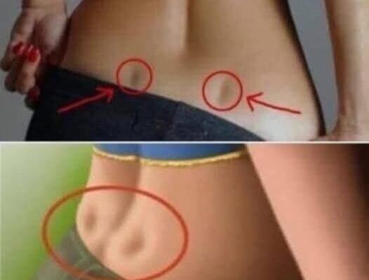 If you have these two holes in your back, it means this
