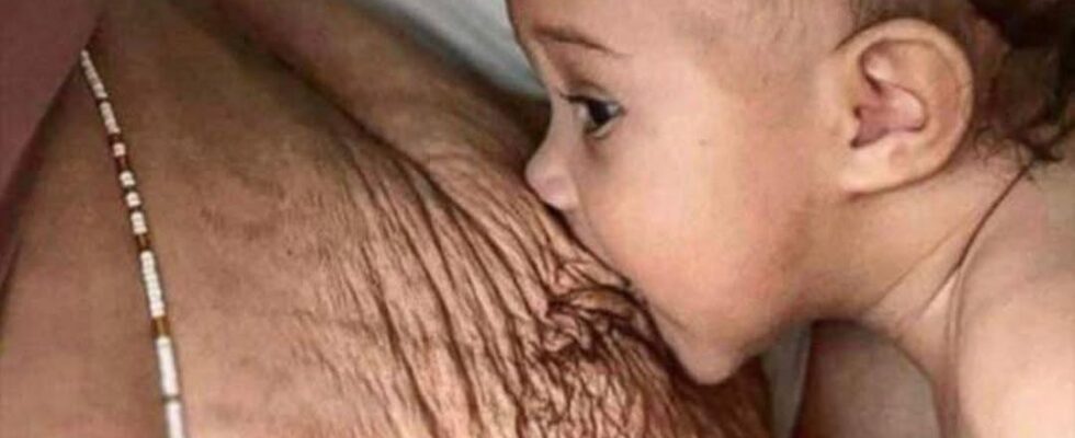 HealthMoms Get Brutally Honest About Post-Baby Bodies — And Fans Are Cheering