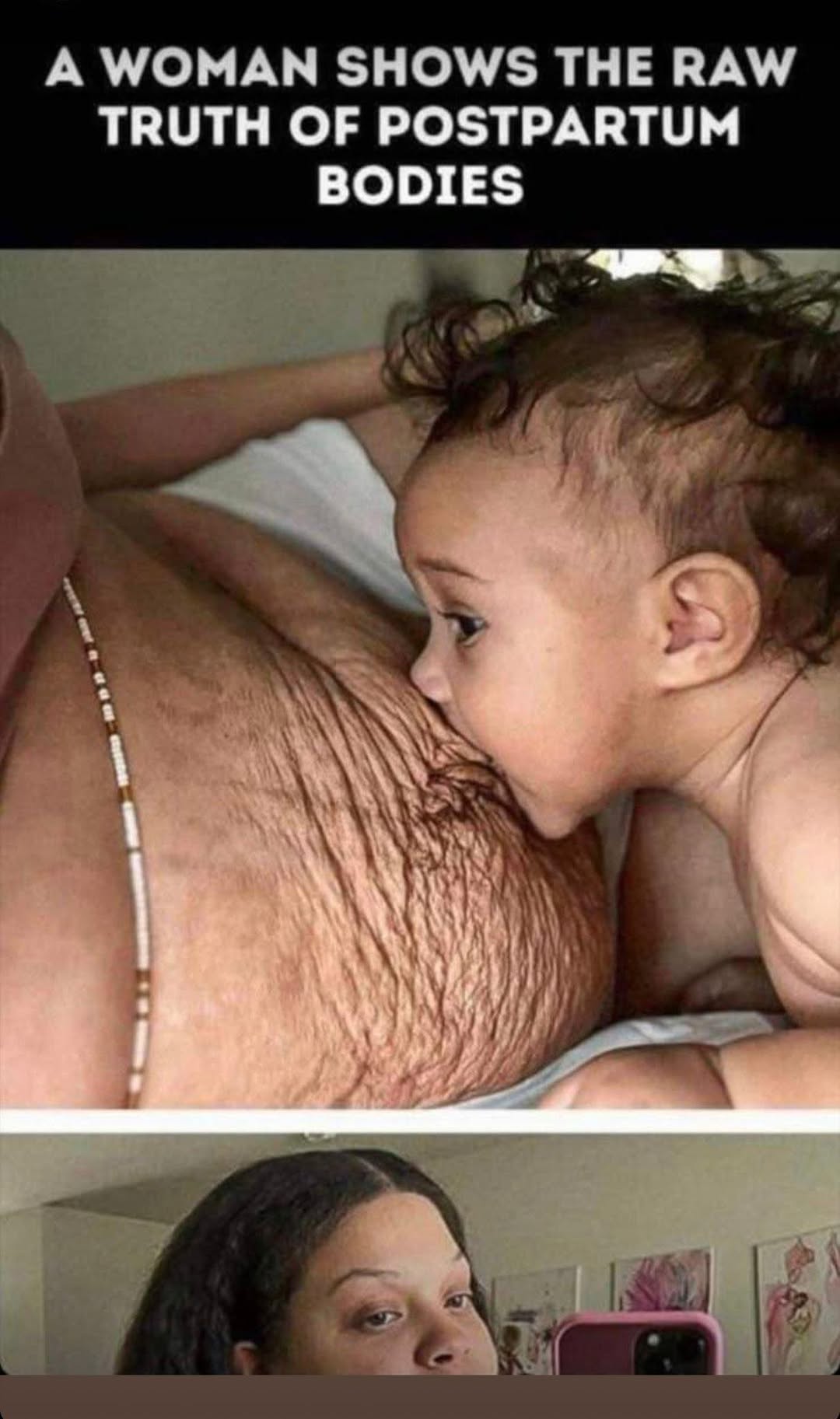 HealthMoms Get Brutally Honest About Post-Baby Bodies — And Fans Are Cheering