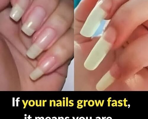 What It Really Means If Your Fingernails Grow Fast and…
