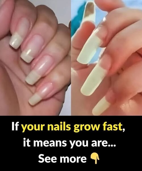 What It Really Means If Your Fingernails Grow Fast and…