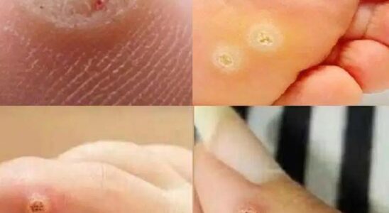 Be very careful if it comes out in your mouth, you are…