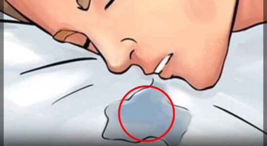 If You Drool While Sleeping Often, Check for These 6…