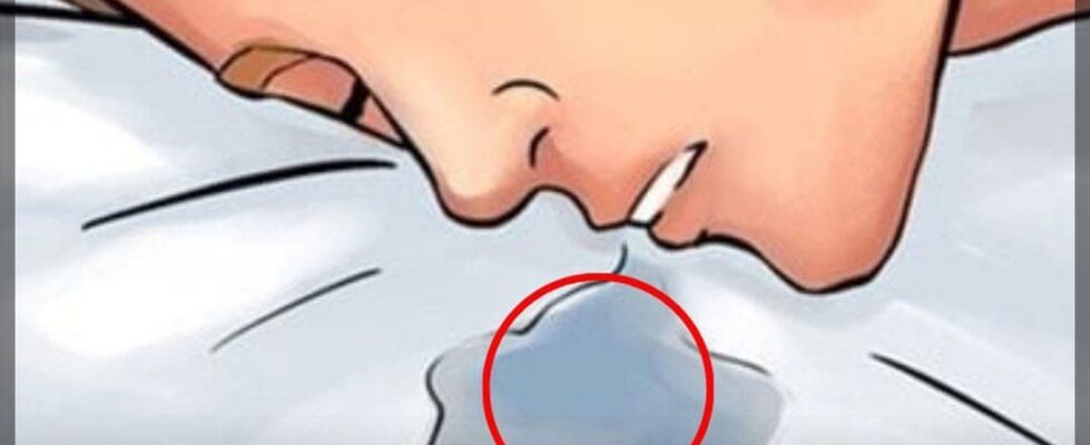 If You Drool While Sleeping Often, Check for These 6…