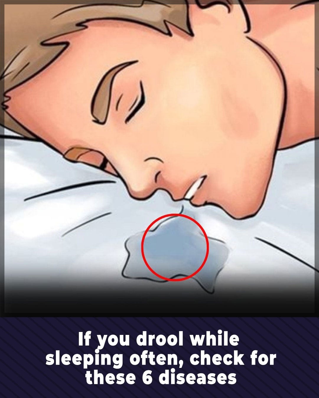 If You Drool While Sleeping Often, Check for These 6…