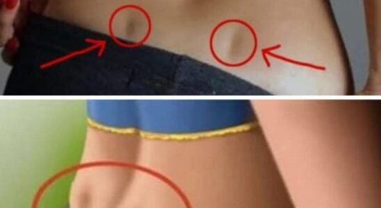 If You Have These Two Holes in Your Back and so…