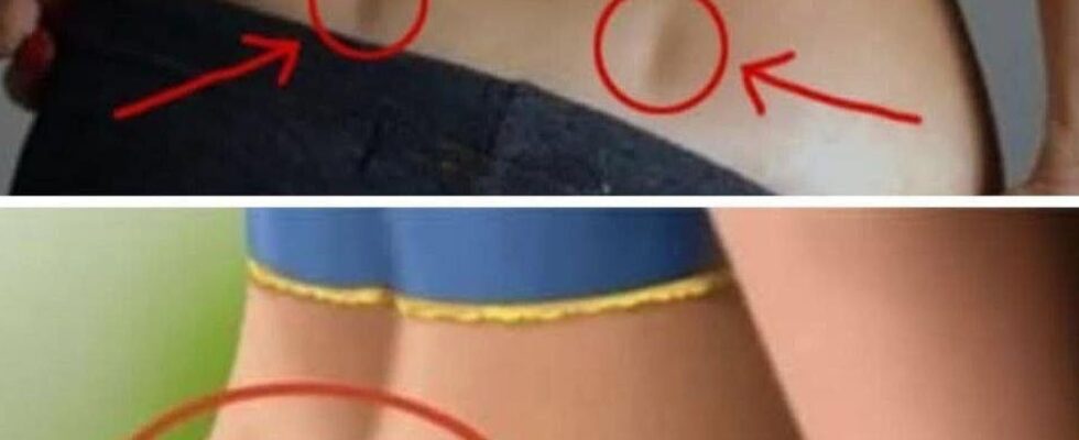 If You Have These Two Holes in Your Back and so…