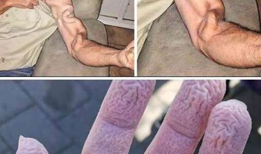 A man goes to stretch and ends up feeling a sharp pain in his arm, it was a ca…
