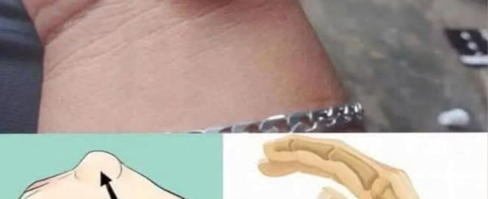 If You Get These Bruises on Your Body, It Might Mean Something Serious